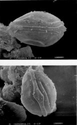 The whirling disease parasite, Myxobolus cerebralis, forms small spores like this one, photographed with an electron microscope. The spores remain viable for dozens of years in the mud, until they are eaten by a small worm known as Tubifex tubifex. When the worms die, they release another phase of the parasite known as a triactinomyxon (TAM) that is ready to infect another fish and complete the life cycle.Photo by Ronald P. Hedrick Whirling Disease Spores